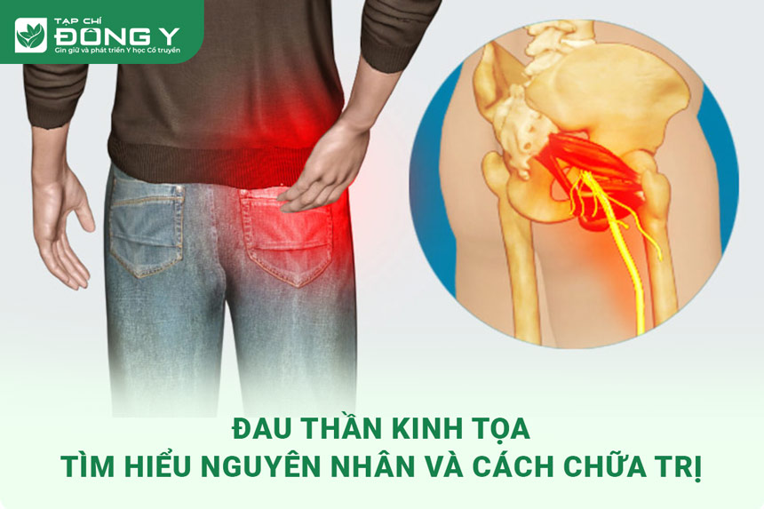 dau-than-kinh-toa