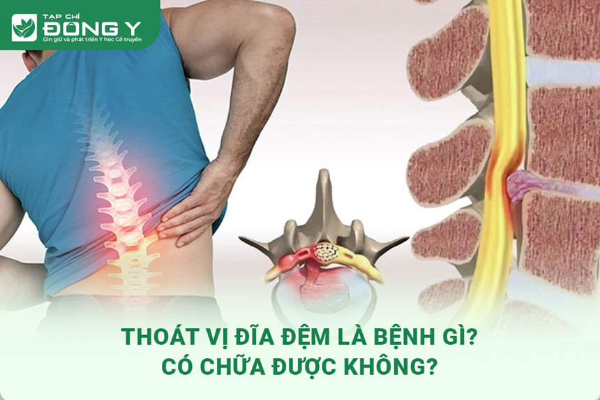 thoat-vi-dia-dem
