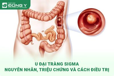 u-dai-trang-sigma