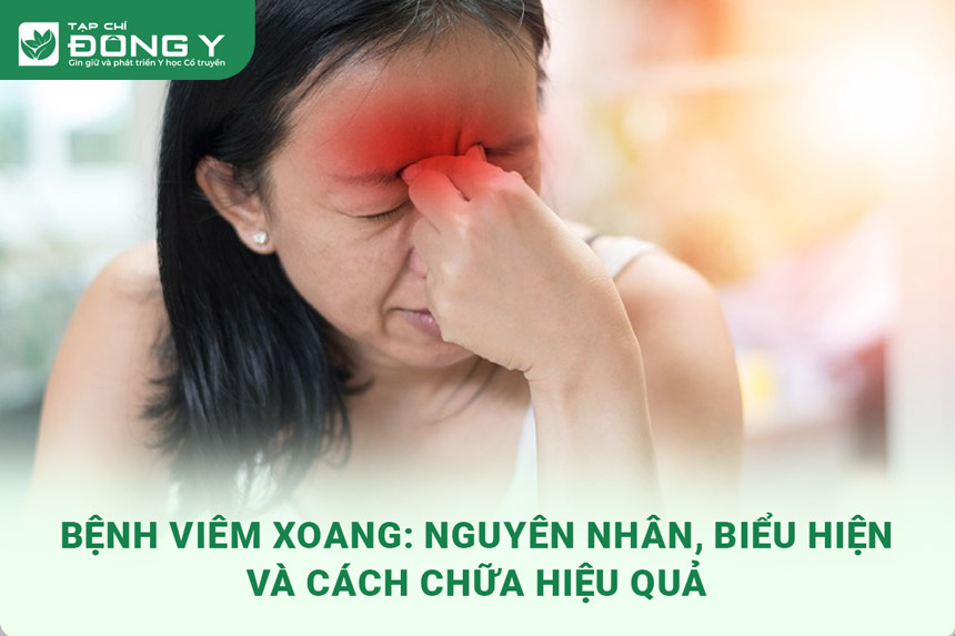 viem-xoang