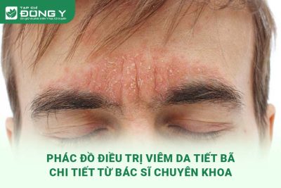 phac-do-dieu-tri-viem-da-tiet-ba