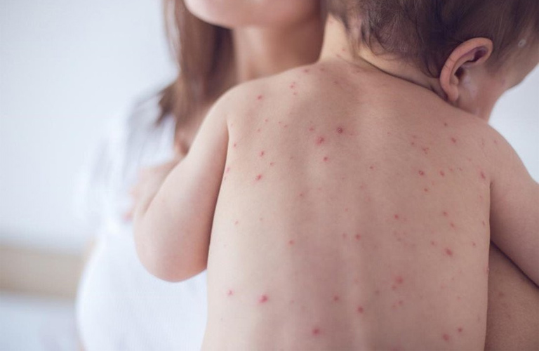 Quan sát biểu hiện lâm sàng là bước đầu để bác sĩ điều trị bệnh