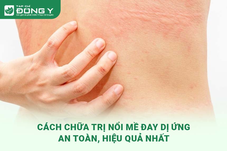 cach-chua-noi-me-day