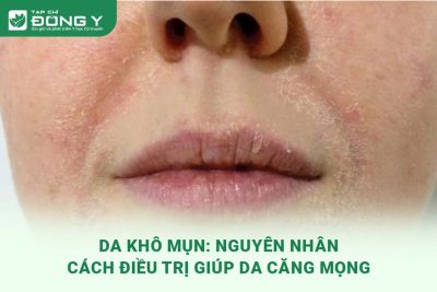 da-kho-mun