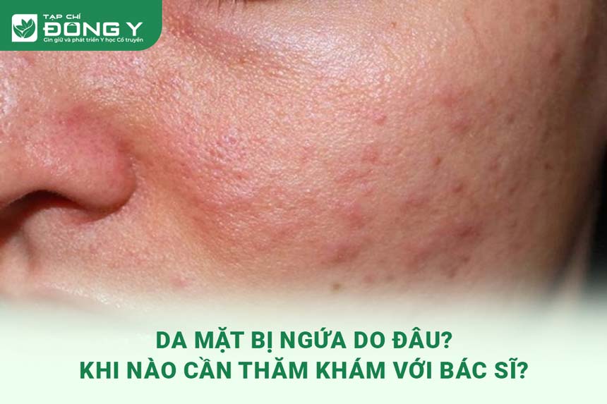 da-mat-bi-ngua
