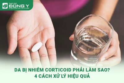 da-bi-nhiem-corticoid-phai-lam-sao