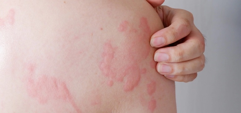 Người bệnh nên đi khám bác sĩ nếu gặp các triệu chứng bất thường