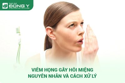 Viêm Họng Gây Hôi Miệng