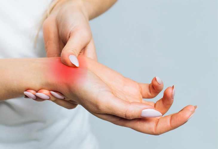 Viêm họng liên cầu khuẩn có thể dẫn đến sốt thấp khớp