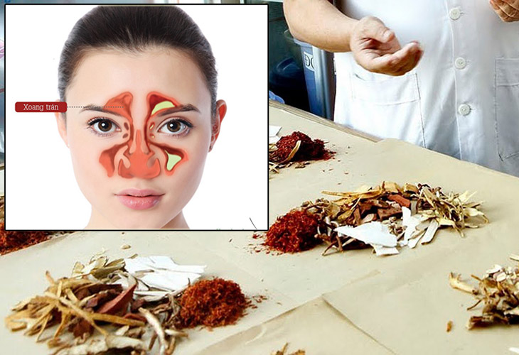 Đông y dùng phép thanh nhiệt, giải độc, khai khiếu để trị bệnh