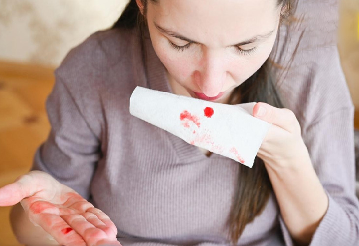 Viêm xoang gây chảy máu mũi là một biến chứng thường gặp của viêm xoang