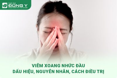 Viêm Xoang Nhức Đầu