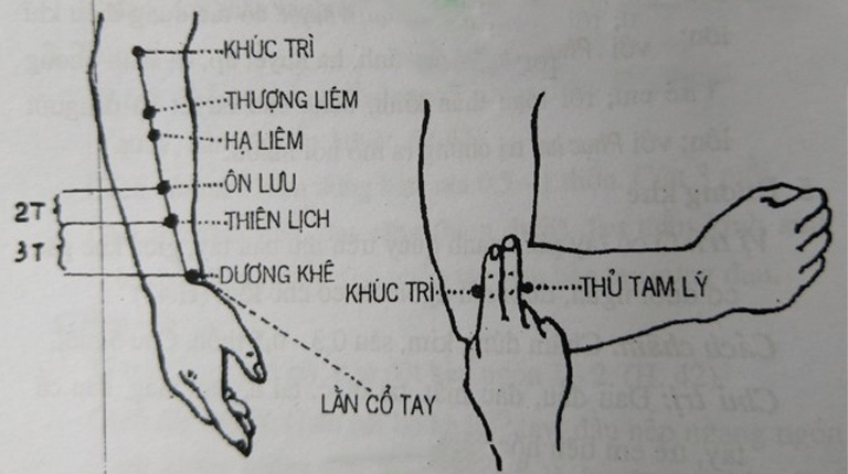 Huyệt Thủ Tam Lý tọa lạc tại vùng cẳng tay trước, thuộc kinh Dương Minh Vị