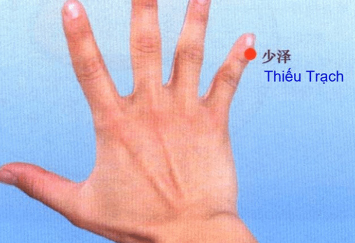 Huyệt Thiếu Trạch nằm ở góc móng tay phía bên trong của ngón út